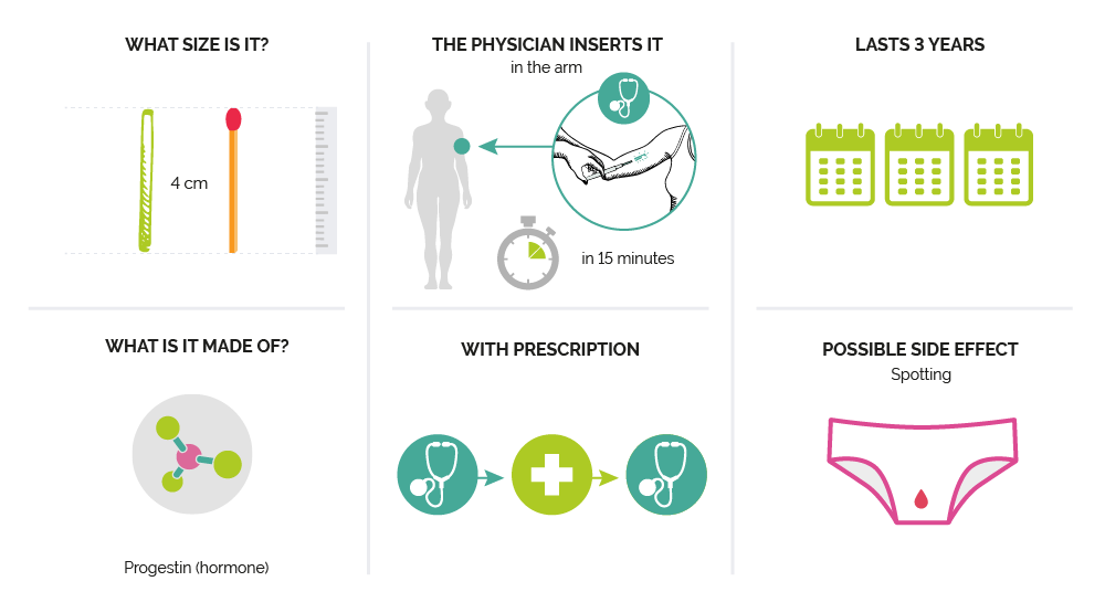 HORMONAL IMPLANT - My Contraception